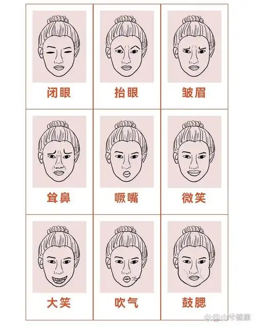 面瘫家庭康复训练三部曲 br>第一曲:额部  br>1,抬眉:训练额肌,恢复额