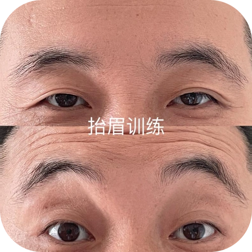 训练六西院区针灸康复科科室以中风病及其后遗症(脑血管病),面瘫病(面