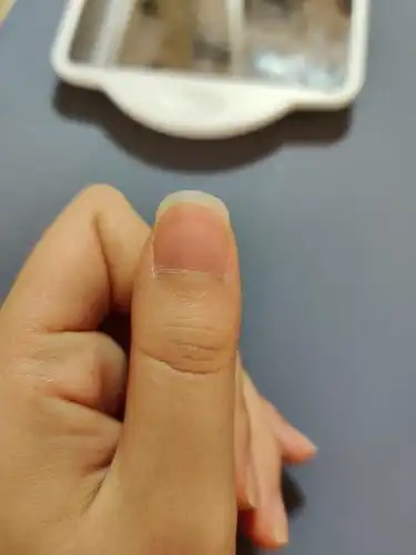 为什么我的大拇指指甲这么宽