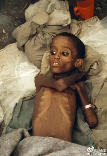 为此,他发起了零饥饿挑战运动,邀请