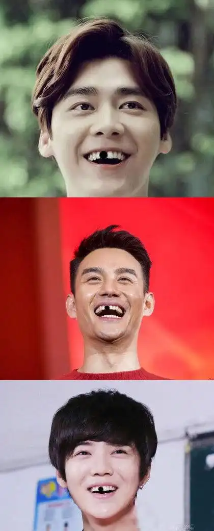 ps出明星们缺牙时的样子(不是我ps的,别打我)