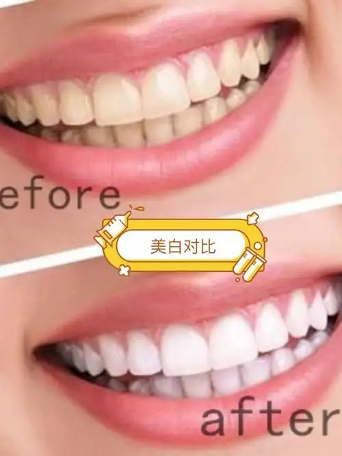 牙齿美白有"绝招"