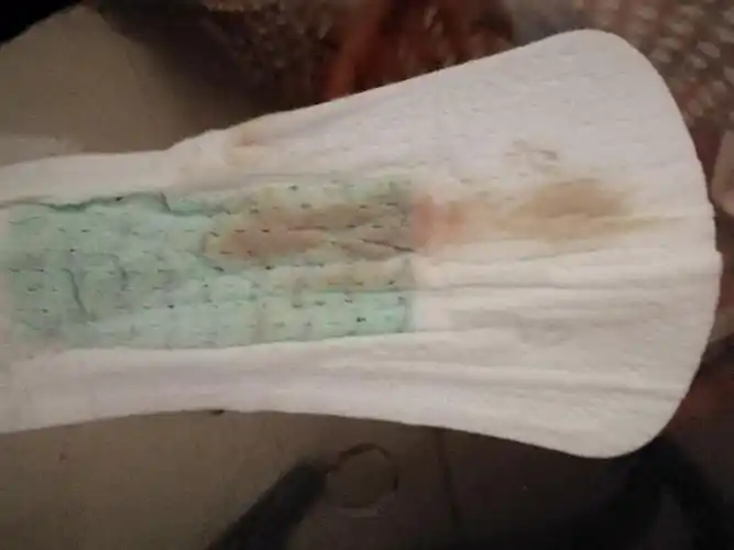 月经6个月没来怎么办 6个月没有来月经怎么回事