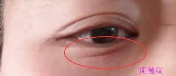 阴骘纹长什么样_手机搜狐网