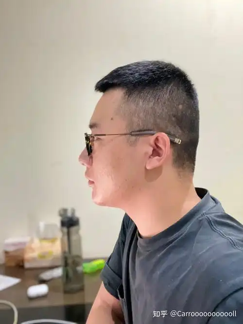 后脑勺平改如何收拾头发?