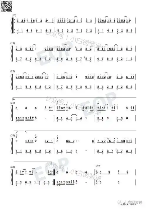 伊格赛听 王雨桐(含简谱)