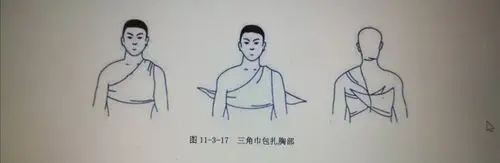 (2)燕尾巾包扎法:将三角巾折成鱼尾状,在底部反折,两角朝上横放于胸部