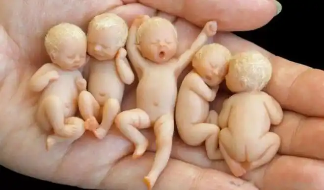 最小的b是多少 只有一条缝的b是什么b介绍