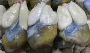 新鲜墨鱼蛋的正确清洗方法,新鲜墨鱼蛋的正确清洗方法是