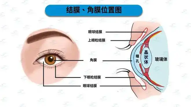 近视手术到底动了眼睛的哪个部位内附福利