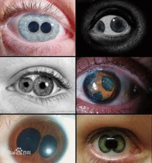 双瞳与重瞳