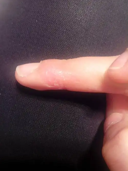 手上原来写字留下的一个茧,现在每次都习惯去撕,现