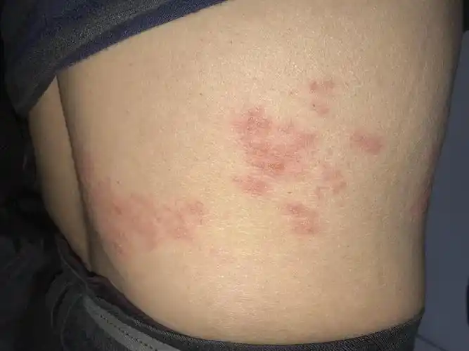 老人肚子突然大了起来难道和缠腰蛇有关系