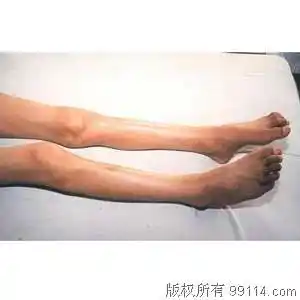 下肢肌肉解剖图|小腿与脚部肌肉解剖图|下肢血管解剖图