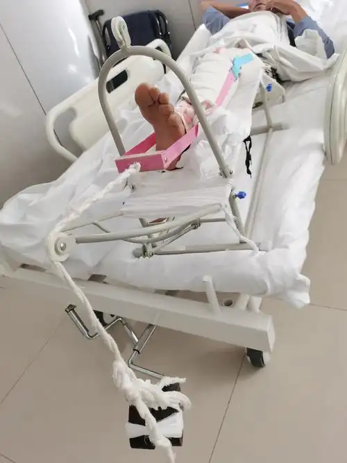 牵引术病人的健康宣教