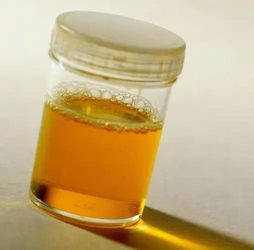 新生儿尿黄尿时哭闹_新生儿尿黄怎么回事,尿时哭闹