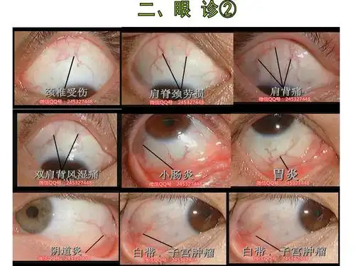 图说甲诊和眼诊(作者:周远广)