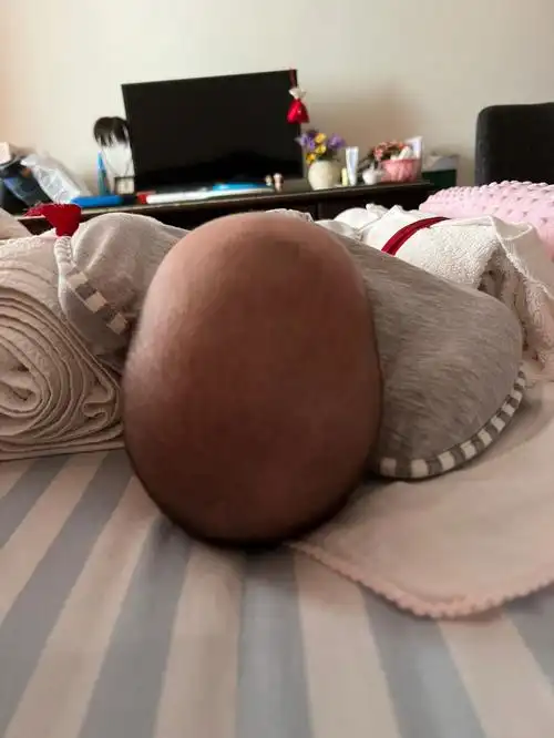 三个月宝宝头型