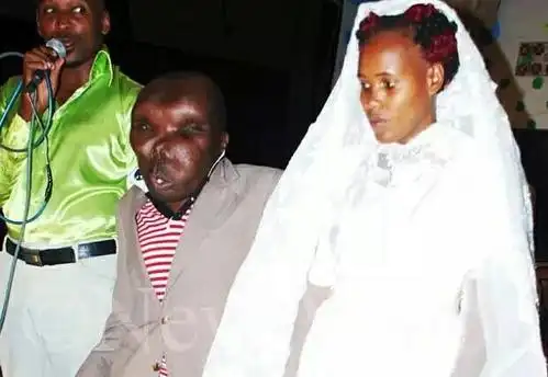 世上最丑的男人胆小勿看