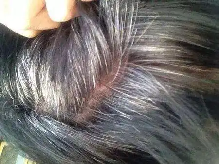 满头白发不要染告诉你一个白发变黑发的秘密