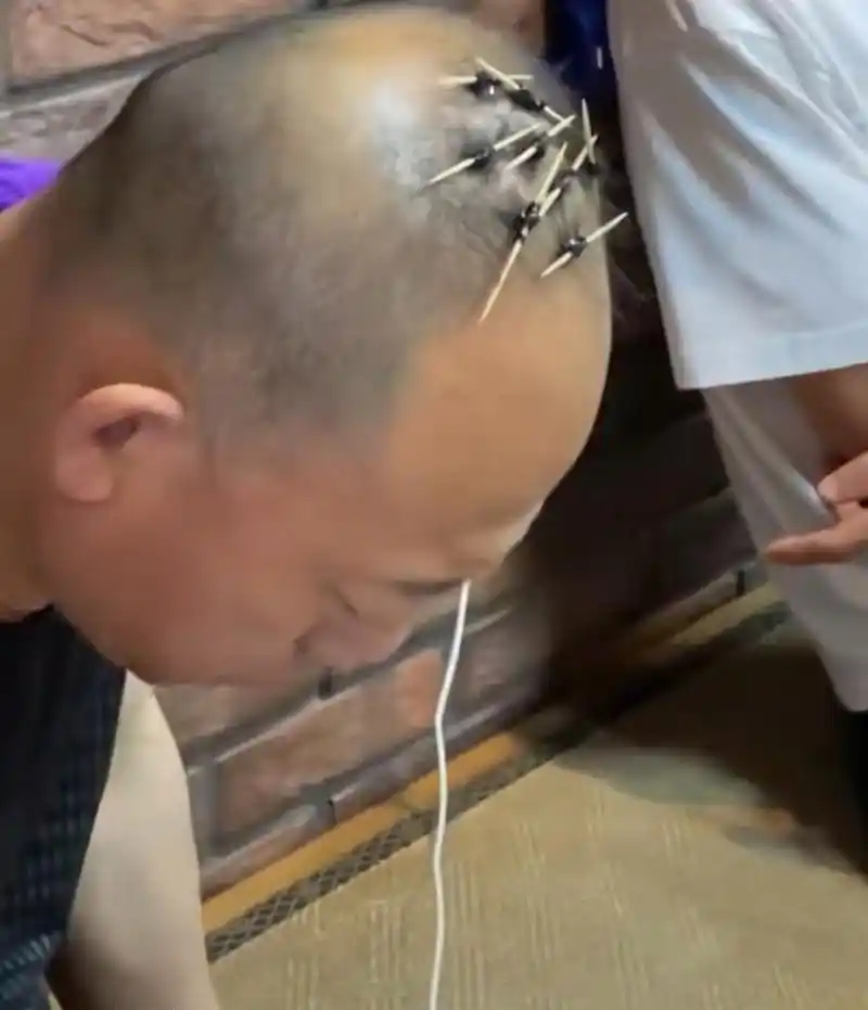 第一次见牙签烫发,一个敢烫,一个真敢烫