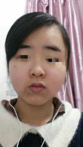 这是大饼脸吗?小眼睛