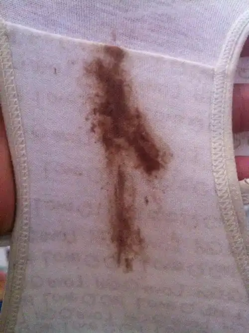 这是内裤上的血,请问这是怎回事