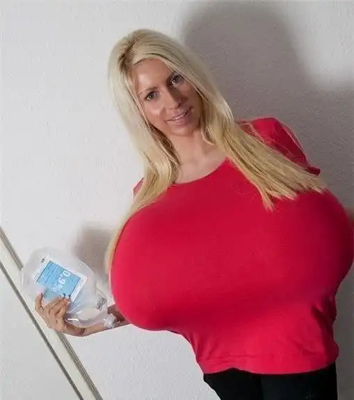 她拥有全球有容"奶"大的"人造"胸部!每天行动不便,而发愁!