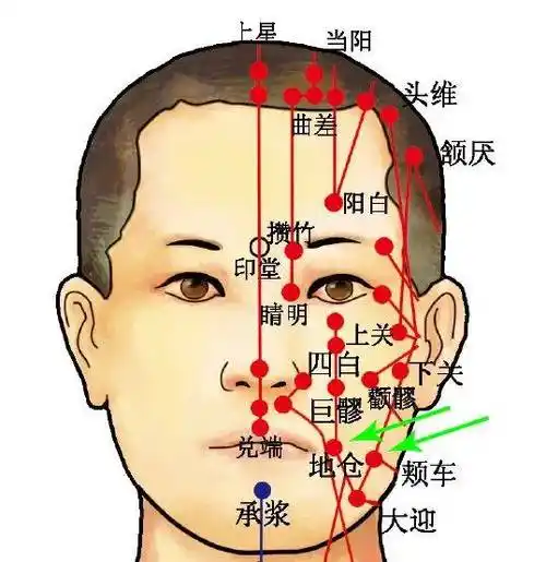 古代中医治面瘫很有心得讲讲补土派的脾胃学说