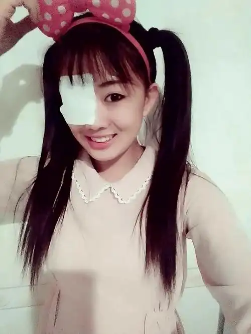 18岁的昕瞳,右眼戴着纱布,在镜头里微笑总体来说,我真是比较乐观的