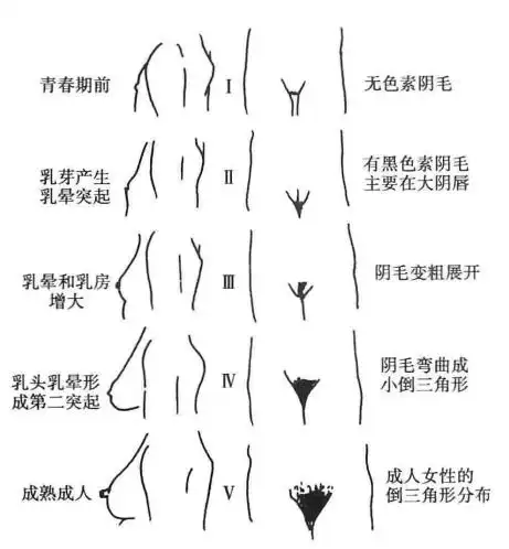 女性青春发育的 tanner 分期