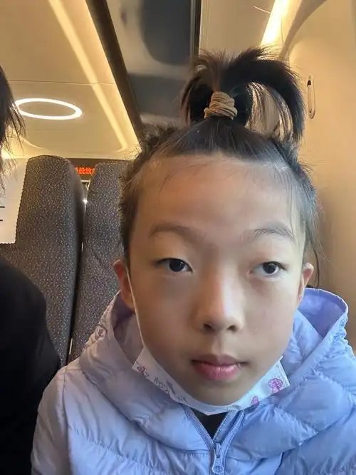 记录95孩子斜视整个过程