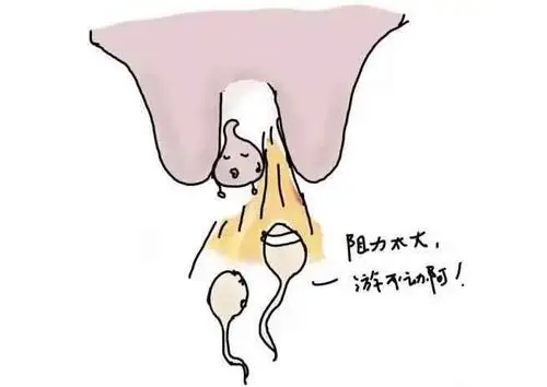 女性宫颈长了息肉会有什么症状