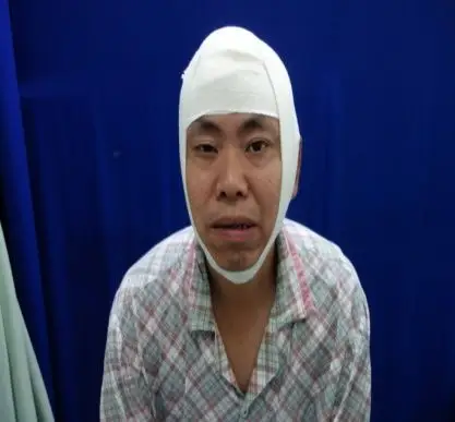 医院-在实践中创新 ---------皮肤二病区开展护理头面部手术伤口包扎