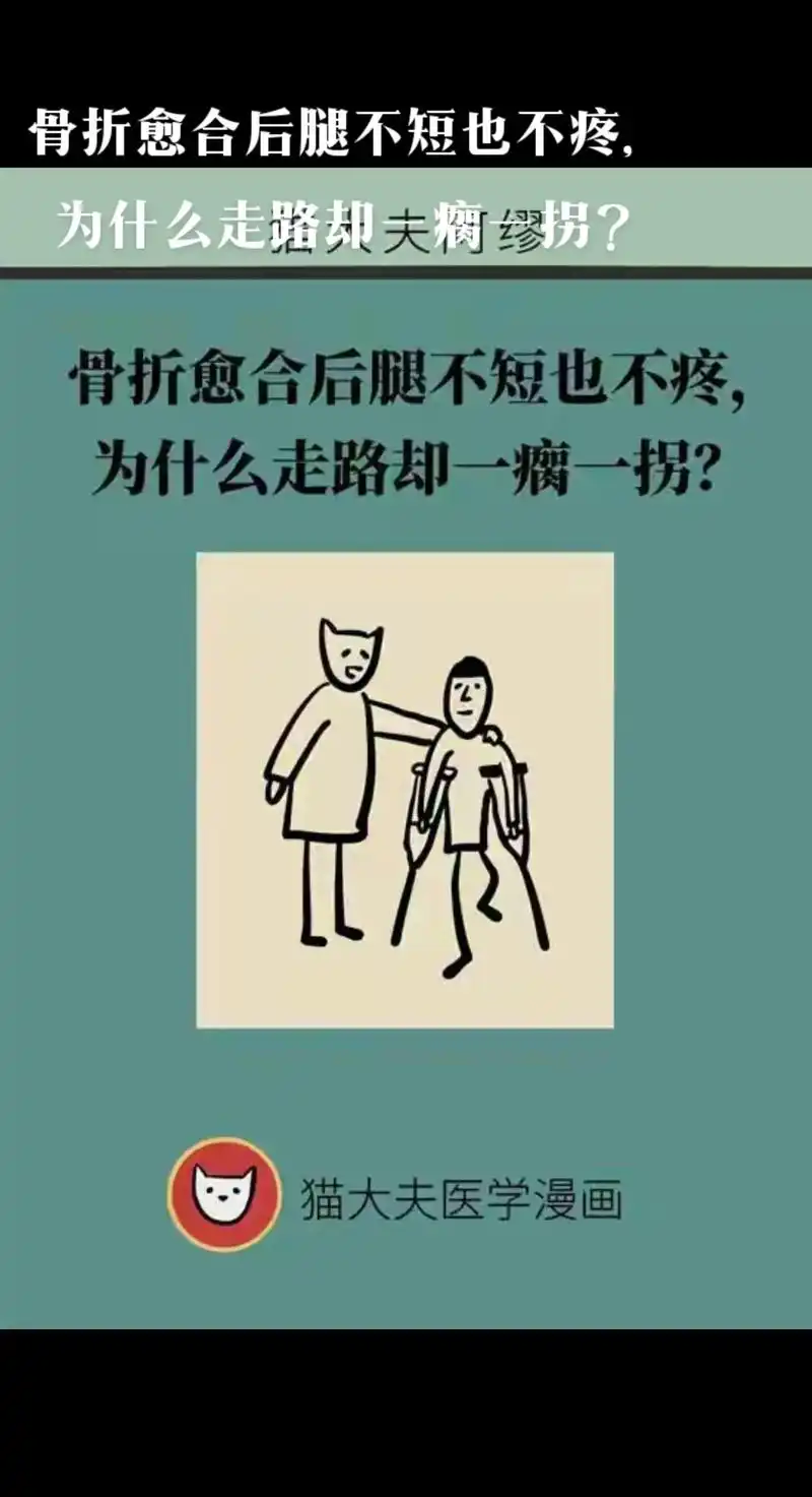 骨折愈合后腿为什么走路却一瘸一拐? - 抖音