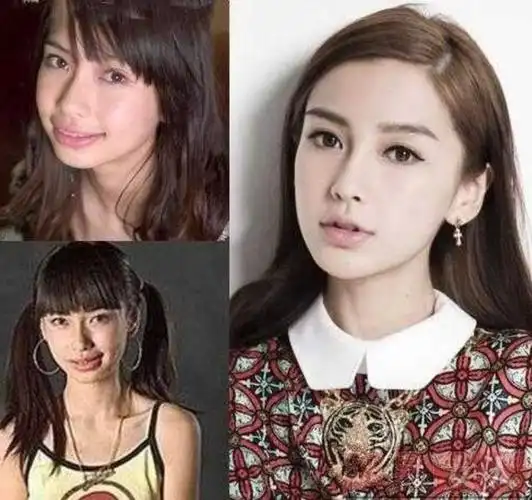 哪些明星整过容(哪些明星整过容对比图)-天晟网