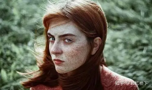 地球最稀有人种红发人濒临灭绝未来将会消失