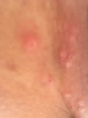 问:就是下面长了小包～我也不知道是什么～帮我看看