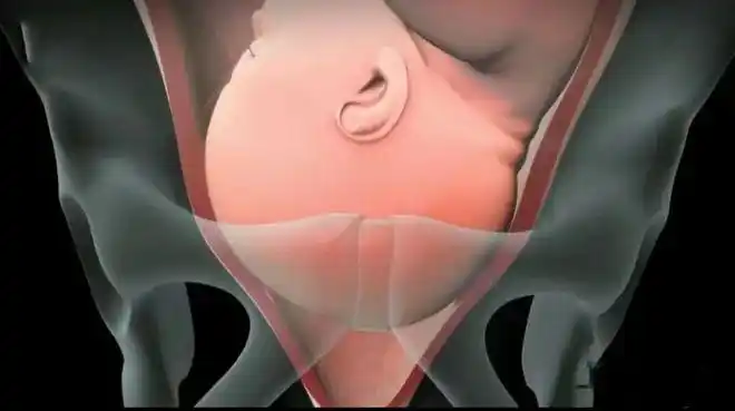 顺产生娃是怎么生的一组3d模拟图带你看懂全过程母爱真伟大