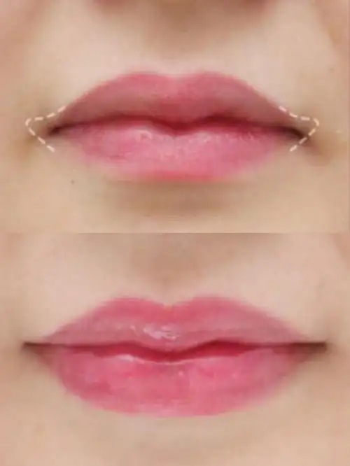 嘴唇影响着我们_圈子-新氧美容整形