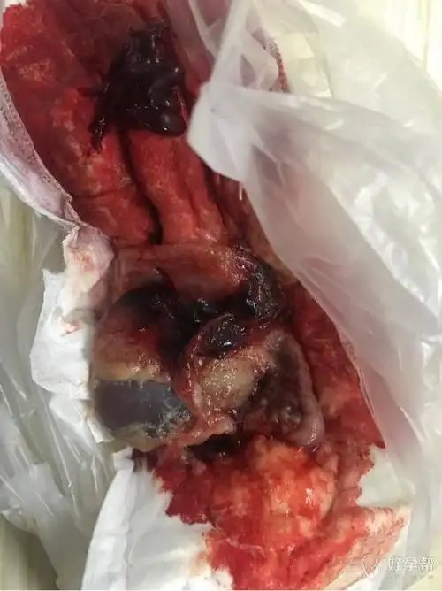 今晚流出来的,是怀孕了吗?