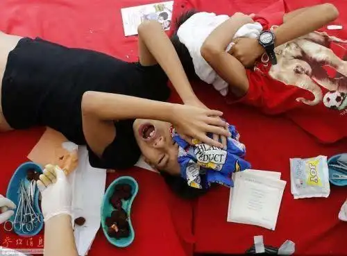 图为一个青少年正在进行割礼手术.他的同学们很惊恐地看着自己被手术.