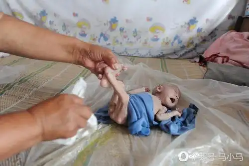 2015年5月7日,27岁的父亲张红青拿着东拼西凑的一万块钱在产房门口等