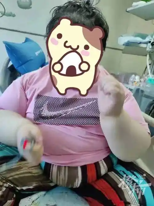 12岁女孩天生贪吃体重近200斤已三进icu得这个病永远感觉吃不饱