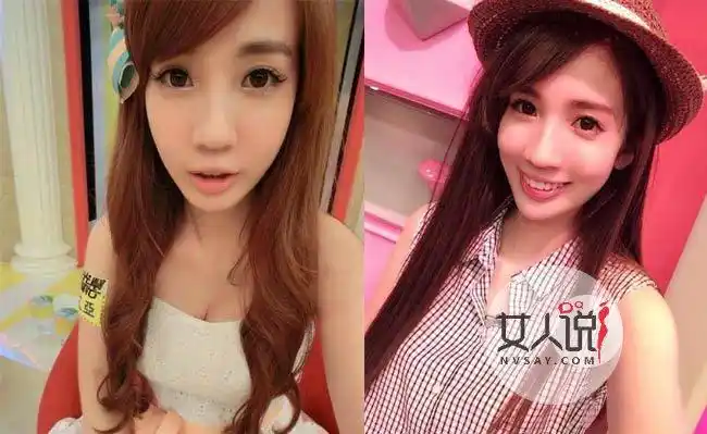 沉寂数月,整形归来的张艾亚,进行了牙齿矫正和疑似进行正颚削骨手术