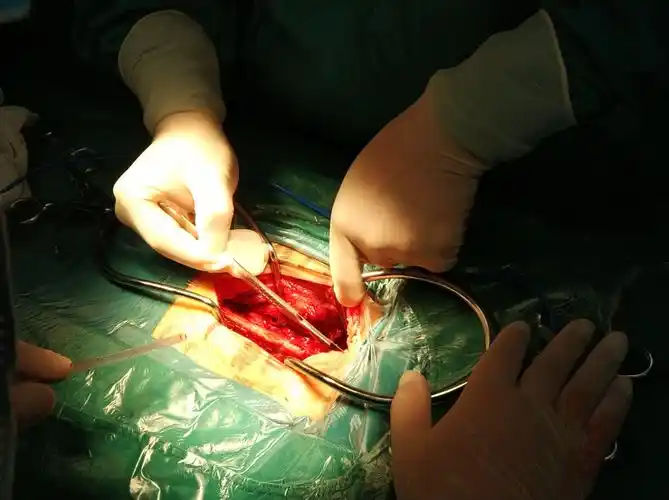 宁夏中医医院暨中医研究院骨科再一例腰椎骨折经皮闭合复位椎弓根钉棒