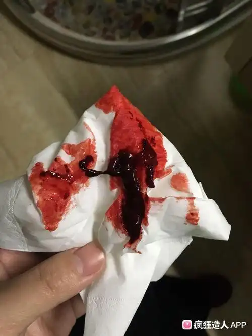 自然流产后第一次月经有血块怎么回事-播种网论坛