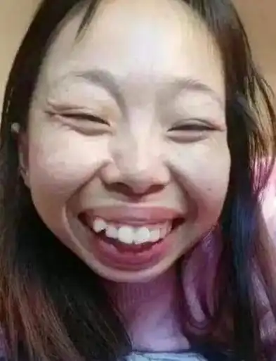 人气,不过其长相真是不敢恭维,很多网友甚至吐槽她是"抖音最丑女网红"