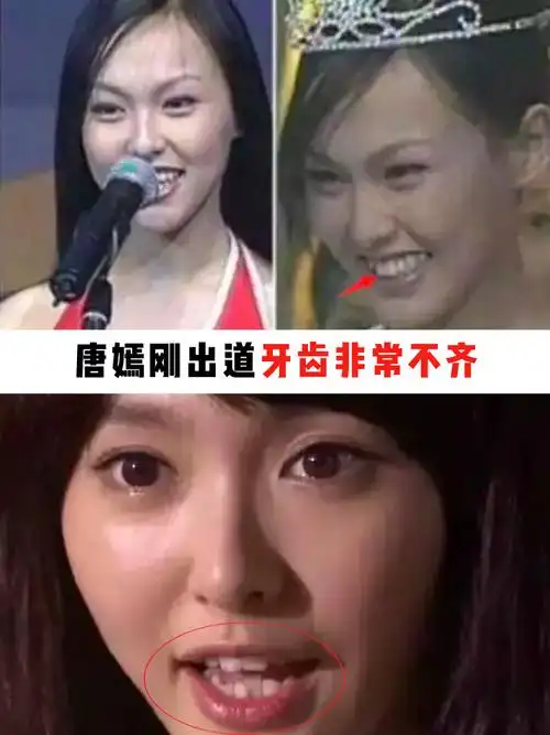 唐嫣的牙齿终于不再靠p图了!