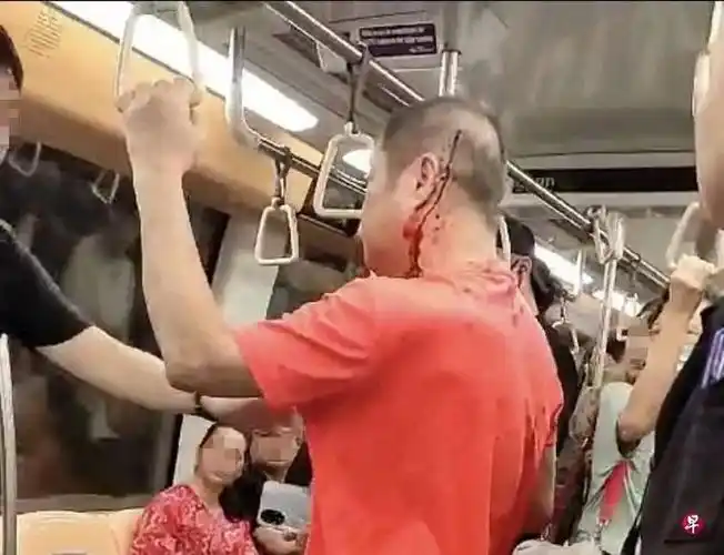 "两男斗殴,他头上鲜血淋漓!"|打架|灰衣_网易订阅